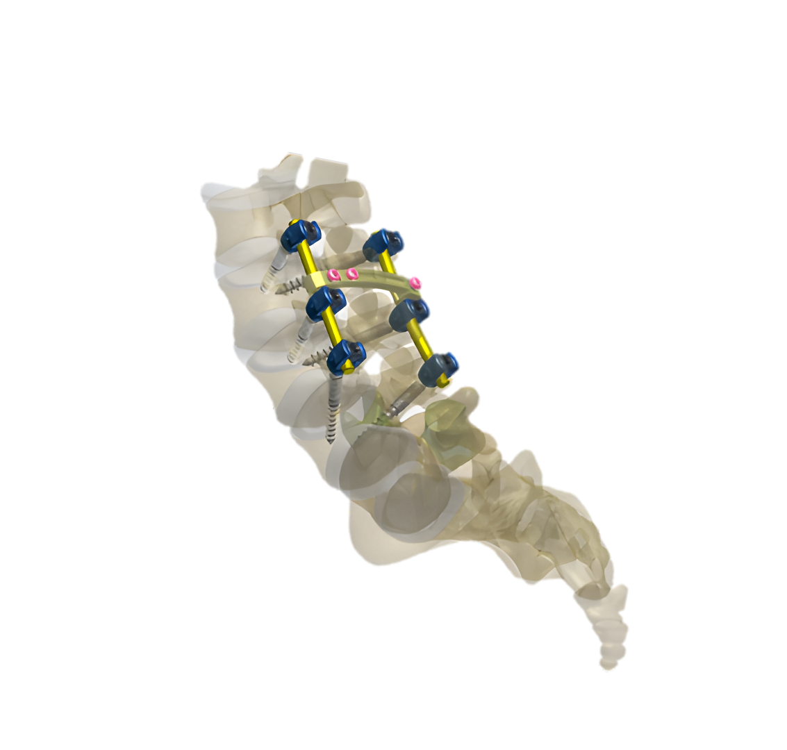 NEPTUNE 5.5 DEGENERATIVE