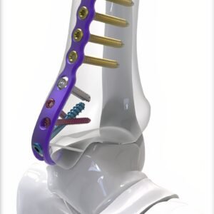 PLACAS DE GANCHO DE BLOQUEO DE TOBILLO