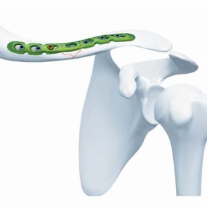 SOLUCIONES PARA CLAVÍCULA